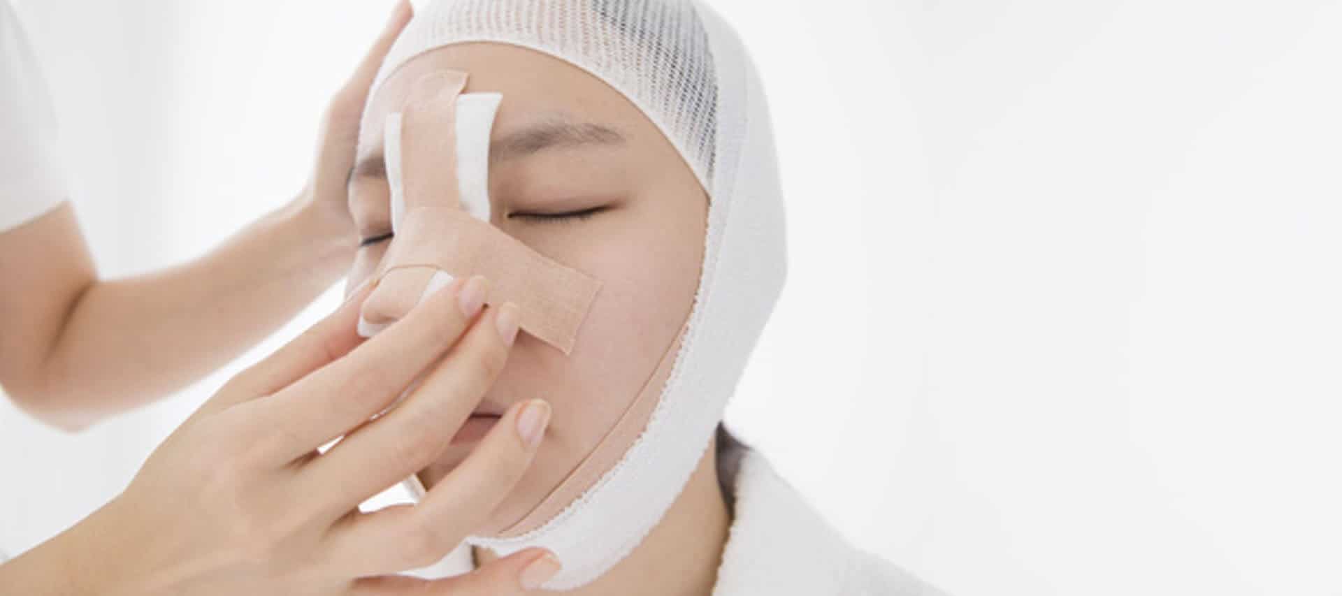 todo sobre la rinoplastia todo sobre la rinoplastia