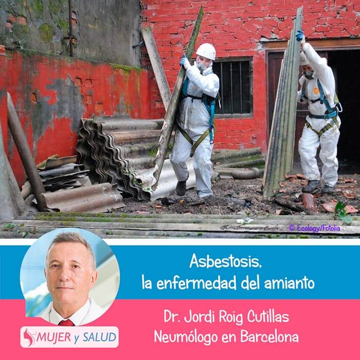 Asbestosis