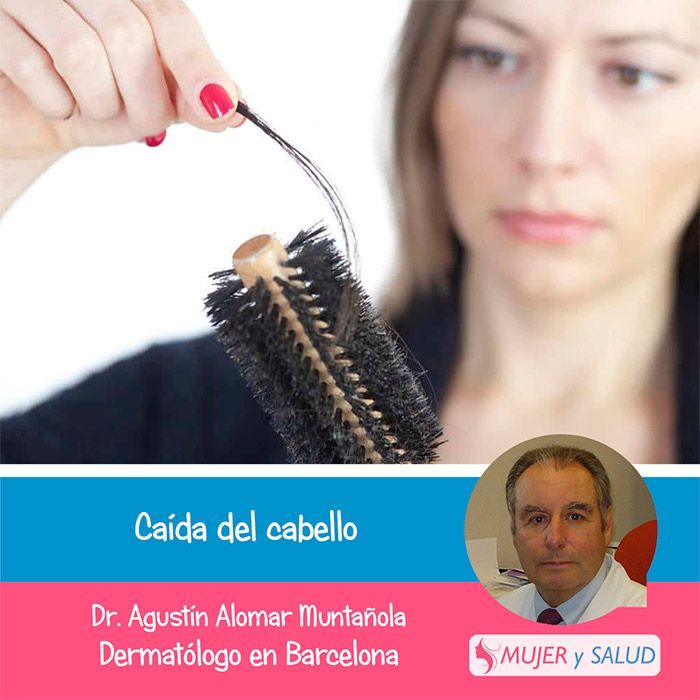 caida de pelo exagerada en mujeres