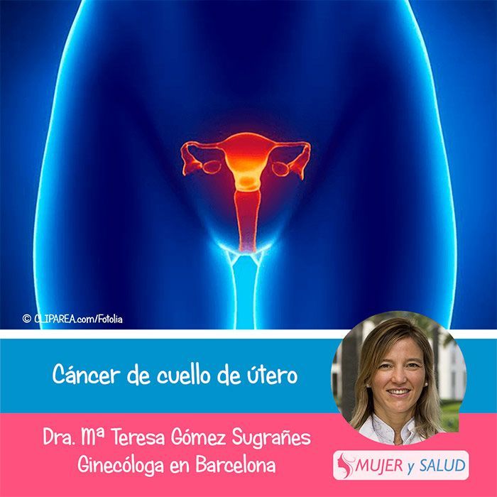 sintomas de cancer de utero