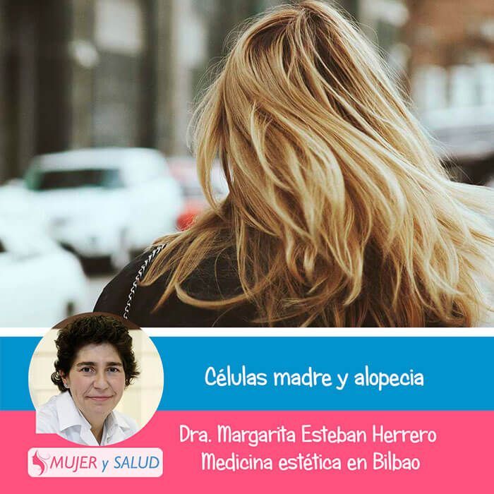 alopecia celulas madre alopecia celulas madre
