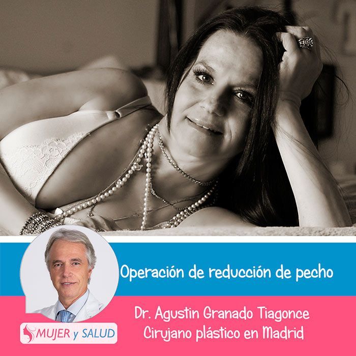 reduccion de pecho experiencias reduccion de pecho experiencias
