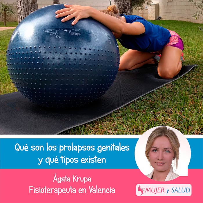 tipos de prolapsos tipos de prolapsos