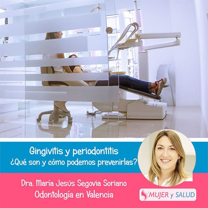  tratamiento gingivitis y periodontitis