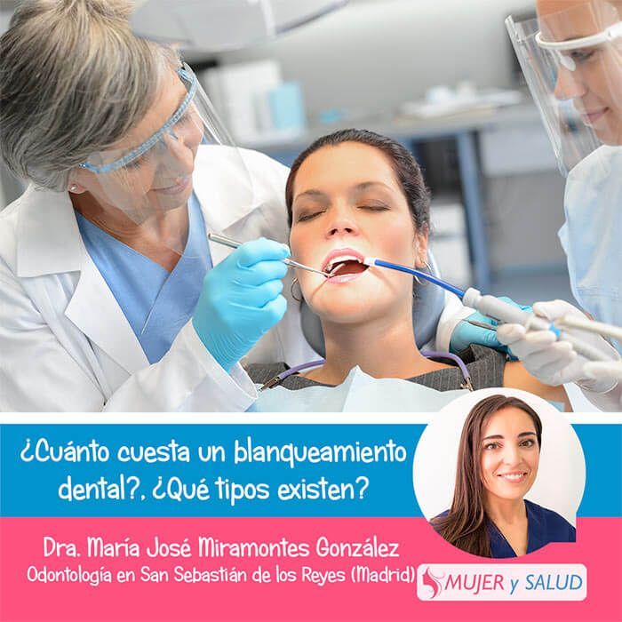Blanqueamiento dental precio