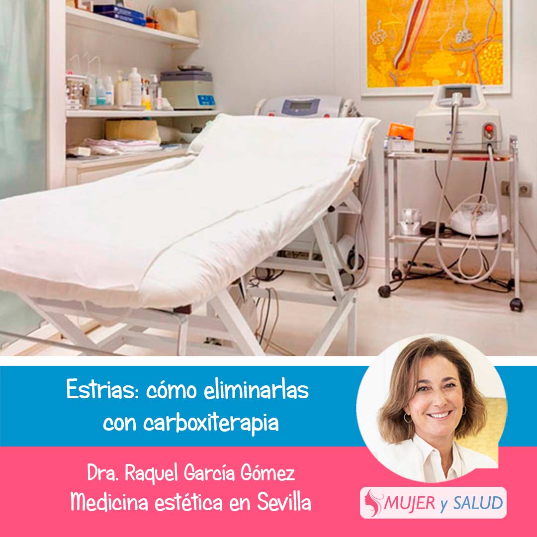 como quitar estrias como quitar estrias